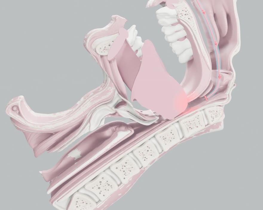 Illustrative cross-section: the tongue has fallen back and blocks the airway